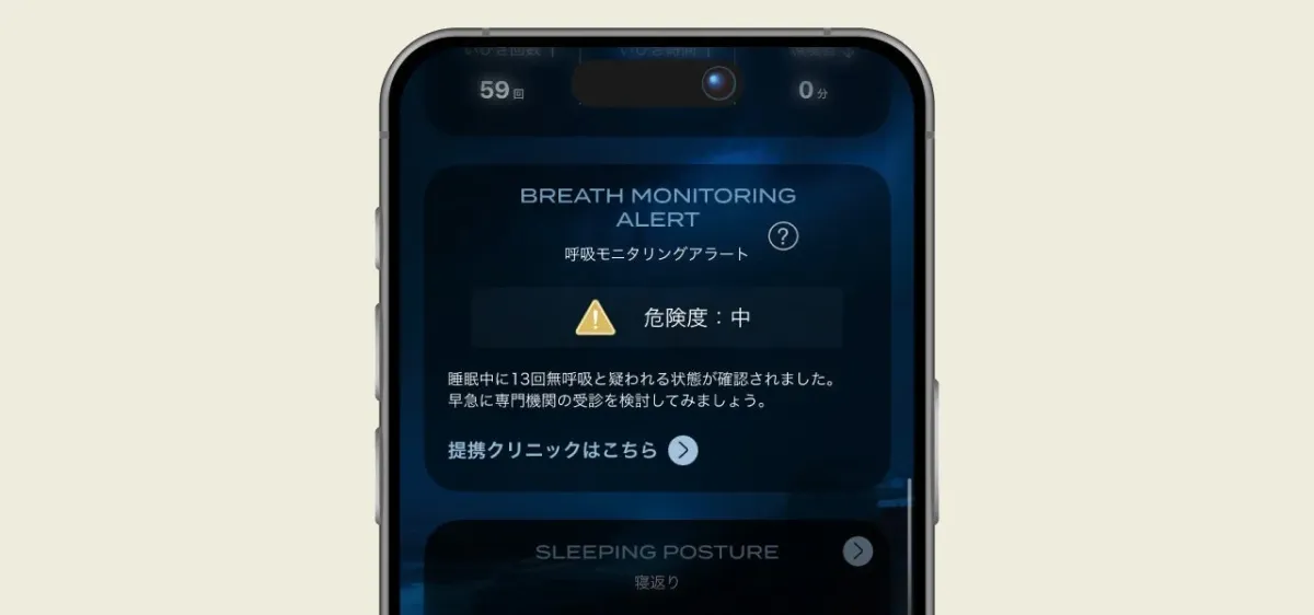 呼吸モニタリングアラート画面