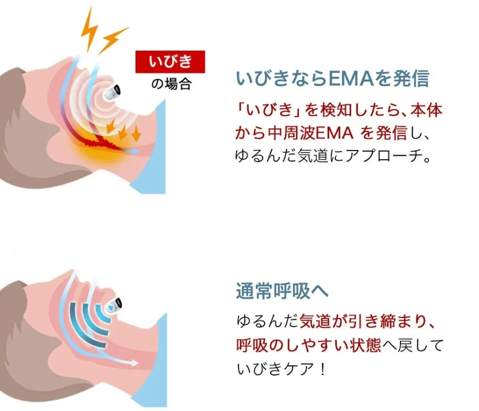 いびきの場合 いびきならEMAを発信 「いびき」を検知したら、本体から中周波EMAを発信し、ゆるんだ気道にアプローチ。 通常呼吸へ ゆるんだ気道が引き締まり、呼吸のしやすい状態へ戻していびきケア!