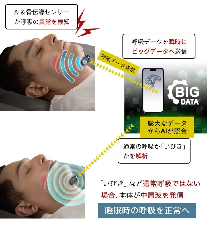 睡眠,呼吸,いびき,AI,骨伝導センサー,ビッグデータ,呼吸異常,睡眠改善,健康管理,テクノロジー